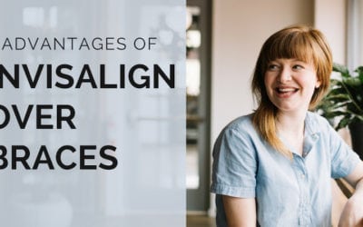 The Top 5 Advantages of Invisalign over Braces