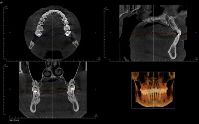 KaVo OP 3D imaging