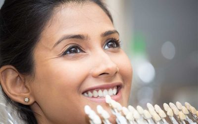 What Are Dental Veneers? Everything You Should Know