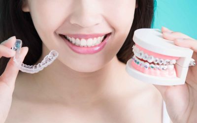 Invisalign vs Braces Which Is Better