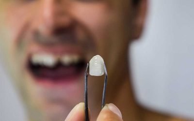 What To Do When Old Dental Work Is Failing
