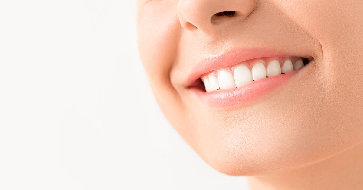 Beautiful,Smile,Young,Woman.,White,Teeth,On,The,Master,Plan.
