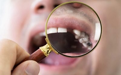Tooth Replacement Without Implants: What Are Your Options?