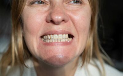 Why You Shouldn’t Ignore a Missing Tooth (Even Just One)